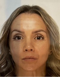 DUNNING Becky