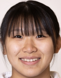 YOKOJI Moe